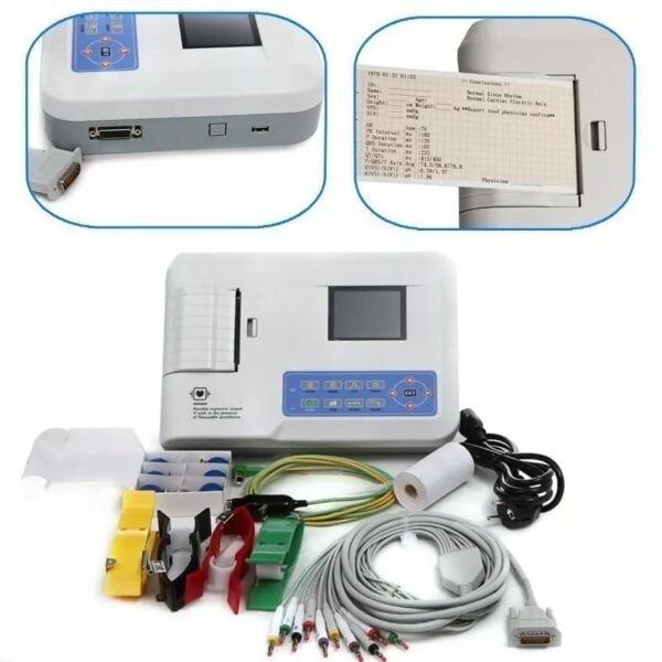 TenTabs CMS 3 Channel ECG Machine 300GA with Interpretation, ECG Storage up to 15 Cases (100 Cases with SD Card), 1.5 Hour Battery Backup Recording & Analyzing Electrocardiogram (ECG) Signals
